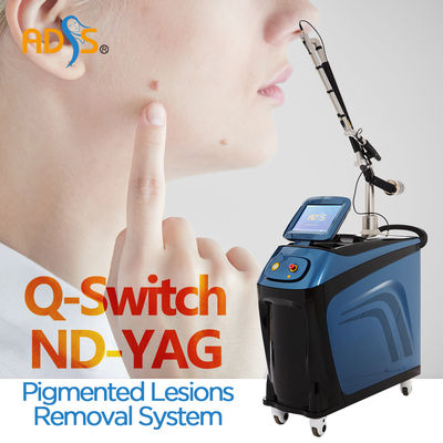 毛の取り外しのためのQによって転換される1064nm ND YAGレーザー機械静止した様式